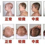 胎儿的头在哪边（胎儿的头在哪边就往哪边睡吗）