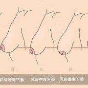 怀孕期间乳房会下垂吗（怀孕期间乳房会下垂吗图片）