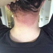 染发对孕妇影响大吗，经常染头发的话，会导致胎儿出现畸形的吗,孕期可以染发吗孕妇专用