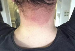 染发对孕妇影响大吗，经常染头发的话，会导致胎儿出现畸形的吗,孕期可以染发吗孕妇专用