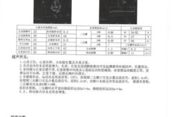 孕妇怀孕几个月能查出宝宝心脏,胎儿心脏彩超要做多久时间