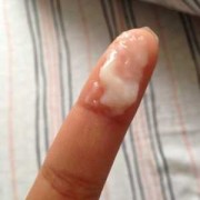 孕期白带异味（流产后白带有异味怎么办）