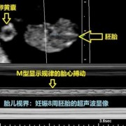 胎儿系统超声检查（胎儿三级超声检查是什么）