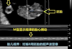 胎儿系统超声检查（胎儿三级超声检查是什么）