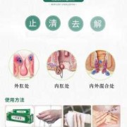 孕期外痔如何消肿（外痔可能是血栓痔，如何尽快消肿止痛）