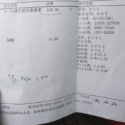 怀孕初期会双腿无力吗？孕期有什么症状是正常的呢,孕期血钾低的原因及危害
