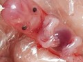 药流的胎儿图片（药流的胎儿图片）