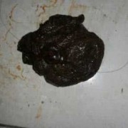 孕期拉不出屎（孕妇拉大便是黑色的怎么回事）
