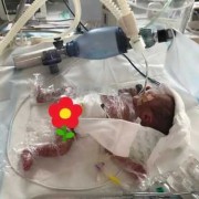 26周胎儿多大（26周婴儿重量）
