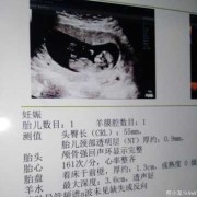 胎儿nt值多少是男孩（胎儿NT值多少是男孩女孩）