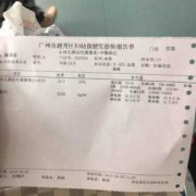孕期抽血化验（孕期抽血化验能查出什么）