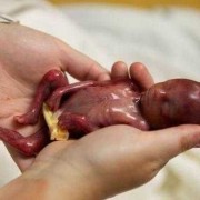 孕28周早产胎儿成活率有多高呢？因为是双胞胎的，所以就早产,孕28周胎儿能存活吗正常吗