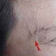 怀孕27周心脏主血管细怎么办,孕期胸部青筋明显是什么原因