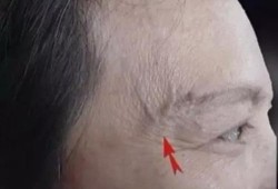 怀孕27周心脏主血管细怎么办,孕期胸部青筋明显是什么原因