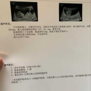 胎儿偏小十天（胎儿偏小十天怎么办,要紧吗）