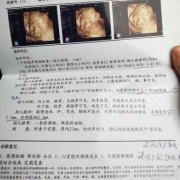 孕28周应该检查什么,28周胎儿做四维彩超要憋尿吗