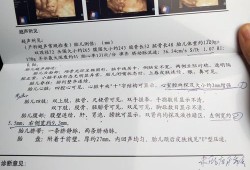 孕28周应该检查什么,28周胎儿做四维彩超要憋尿吗