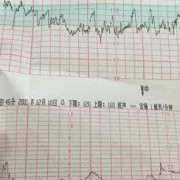 胎儿胎心过慢是什么原因,胎儿心跳慢是什么原因造成的
