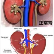 胎儿无右肾（胎儿无右肾是什么原因）