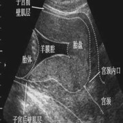 胎儿三级超声检查是什么,合项胎儿系统超声检查什么