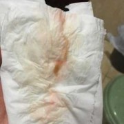 孕期流血会影响胎儿吗（怀孕13周，突然见红是怎么回事，宝宝会不会有危险，挺着急的）