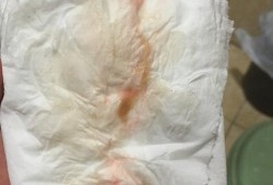 孕期流血会影响胎儿吗（怀孕13周，突然见红是怎么回事，宝宝会不会有危险，挺着急的）