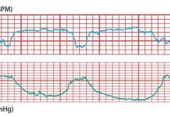 胎儿心率多少,胎儿心跳是什么声音的
