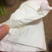 孕期胶状白带（怀孕8周大便之后流出一根粘稠状的白带啥情况）