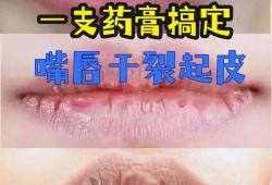 孕妇嘴唇干裂脱皮怎么办,孕妇唇干裂怎么办
