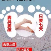 孕期脚气怎么办（孕期的脚气该怎样治疗）