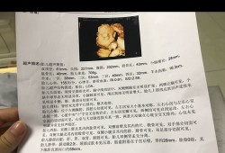 24周胎儿有多大,24周胎儿四维彩超数据标准值