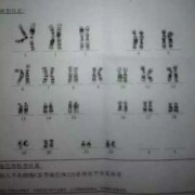 从b超单看胎儿性别（从b超单看胎儿性别准吗）