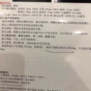 胎儿心率152是男孩女孩（胎儿心率152是男孩女孩啊）