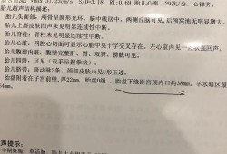 胎儿心率152是男孩女孩（胎儿心率152是男孩女孩啊）