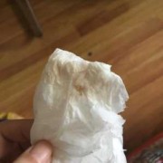 怀孕初期小便后纸上血怎么回事,怀孕期间小便出血怎么回事儿