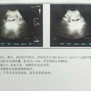 孕囊是胎儿吗（孕囊的读音）