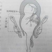 胎儿前肩（胎儿前肩是哪个部位）