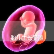 生长受限胎儿小5周（胎儿宫内生长受限是什么？需要注意什么）