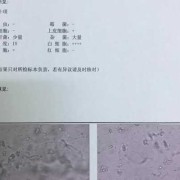 孕期白带清洁度4怎么办（孕晚期白带化验出清洁度4，该怎么治疗）
