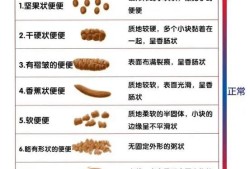 怀孕期间大便不成形（大便不成型的原因）