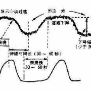 胎儿fhr是什么意思（胎儿FHR是什么意思呢）