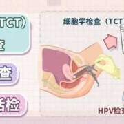外阴痒，白带常规检查正常，TCT，hpv也正常那是什么原因呢,孕期检查正常胎儿出生就一定正常吗
