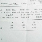 l和p哪个是左,胎儿lop位是什么意思