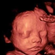 24周胎宝宝在肚子里的样子,怀孕24周胎儿真实图片欣赏