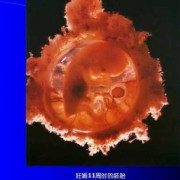 顽强的胎儿（顽强的胎儿说明什么）