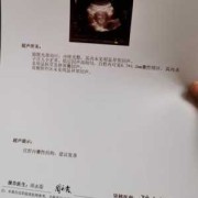 孕期彩超图（孕期彩超图片）