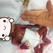 二十五周胎儿有多大,25周胎儿图片 真实