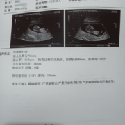 从2020年12月15号至2021年的12月15号一共多少周,胎儿15周有多大图片