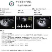 孕妇nf检查是什么意思,胎儿NF是什么意思