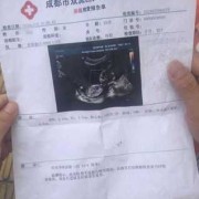 彩超隔多久可以做一次啊？一般情况下怀孕后要做几次彩超,怀孕期间要做几次b超检查